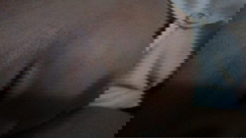 Saran Obat luar untuk alergi cuaca panas? Selain caladine