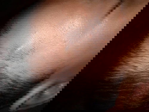 Benjolan keras didahi