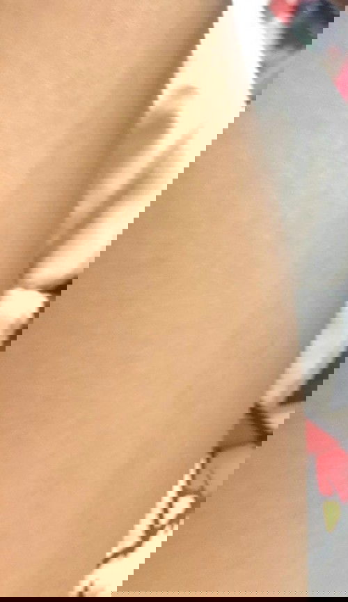 ขาเป็น2สี ท้อง34สัปดาห์