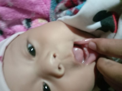 ฟันน้องขึ้นตอน4เดือนกว่า แม่ๆว่าปกติไหม