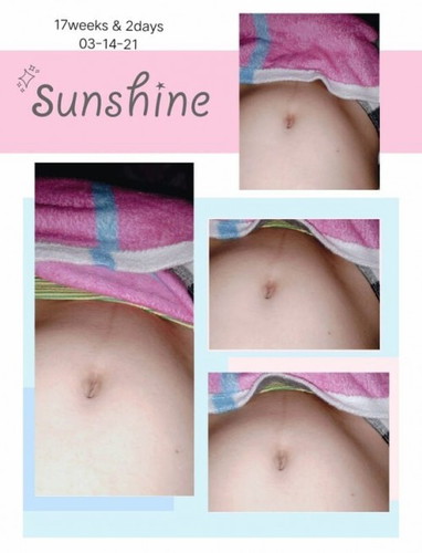 Pwede na po ba mag pa ultrasound kapag 17 weeks & 3 days na?