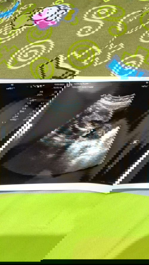 Assalamualaikum Bun mau nanya