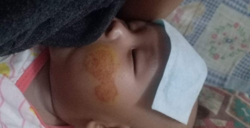 มีแม่ๆบ้านไหนที่ลูกเคยเป็นไหมค่ะ