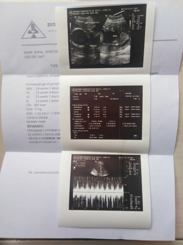 Result ultrasound