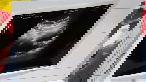 Semoga dijawab bunda