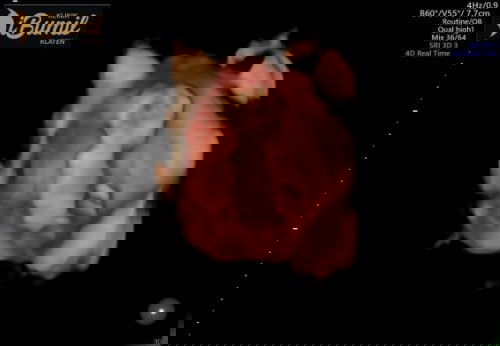 Mengetahui Jenis kelamin Janin