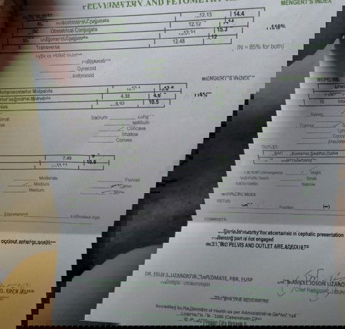 Normal or CS? Ano po Kaya ibig sabihin neto ?