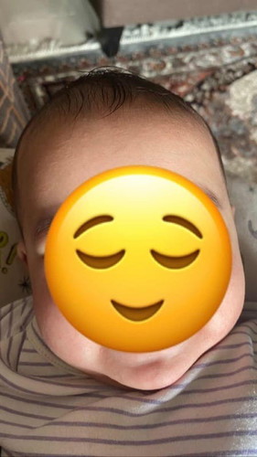 Naik ruam lepas first time bagi makan 6months