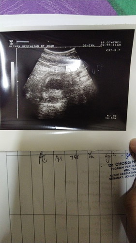 11 week tak nampak baby