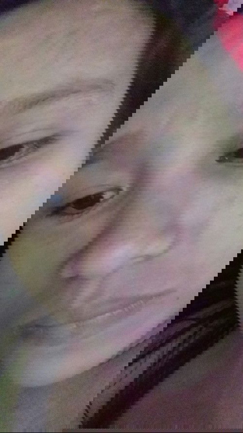 Bund mau tanya
Adakah bunda bunda disini yang lagi hamil mengalami gata gatàl seperti ruam merah