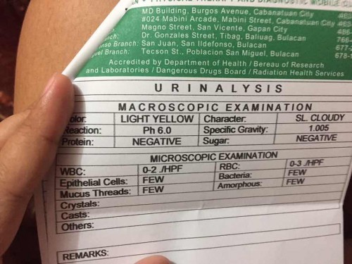 Urine Test Paki read po sa marunong🥰