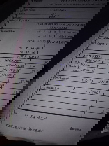 Gimanaa sihh bundd" cara cepat nurunin kolestrol