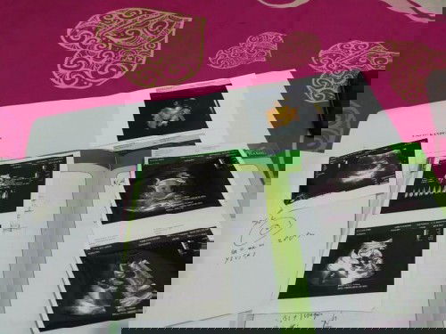 HPL yang maju terus setiap USG