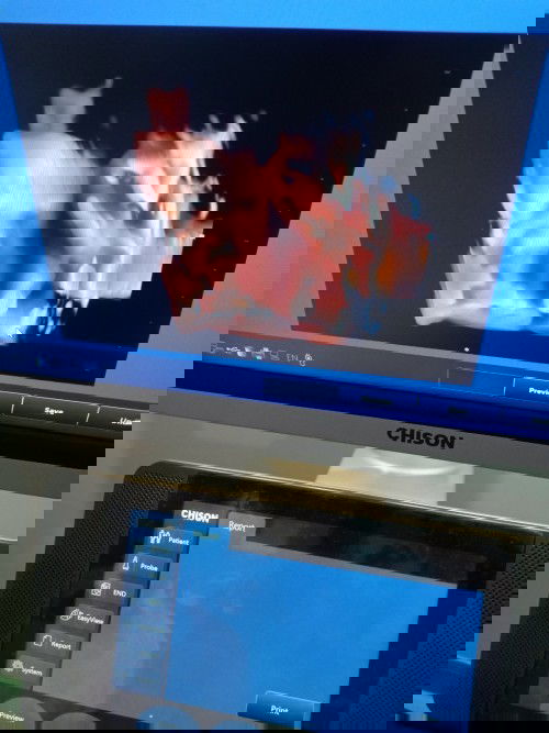 29week  1500 กรัมค่ะลูกสาวน้อยๆ