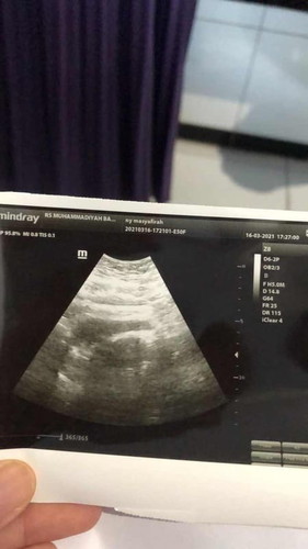 Testpack positif, tidak terlihat tapi rahim membesar?