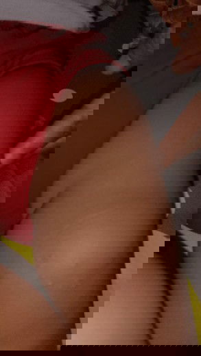 Muncul bintik-bintik