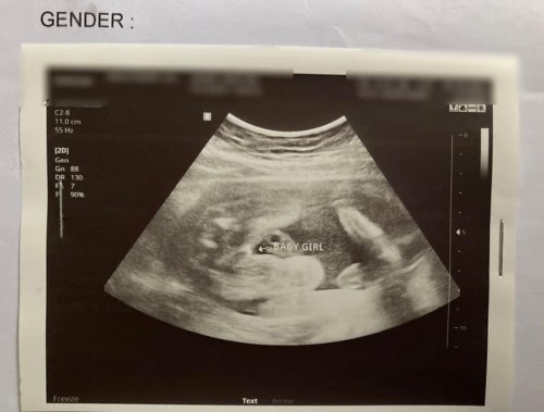 Baby Girl!? Ano po sa tingin niyo?