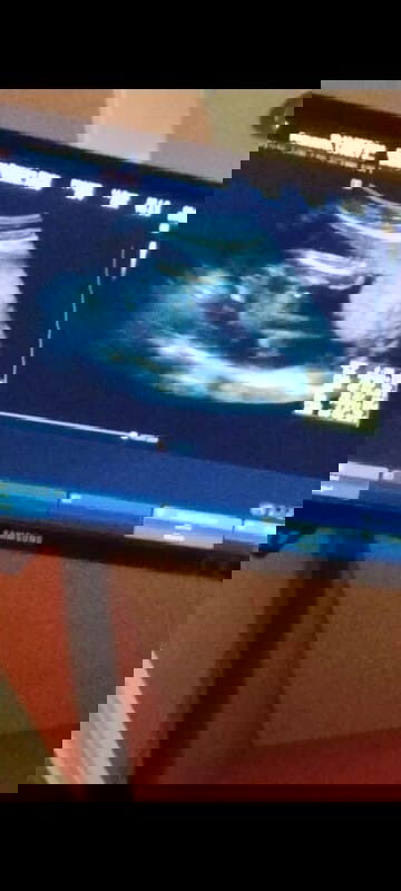 marunong ka po mag basa ng Ultrasound?