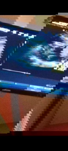 marunong ka po mag basa ng Ultrasound?