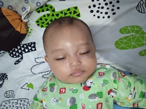 Kulit wajah bayi tidak rata
