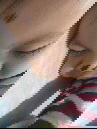 Sugat sa mukha nadapa si baby