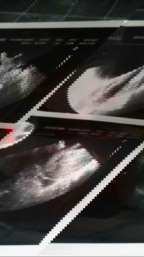 Menunggu kehamilan lagi