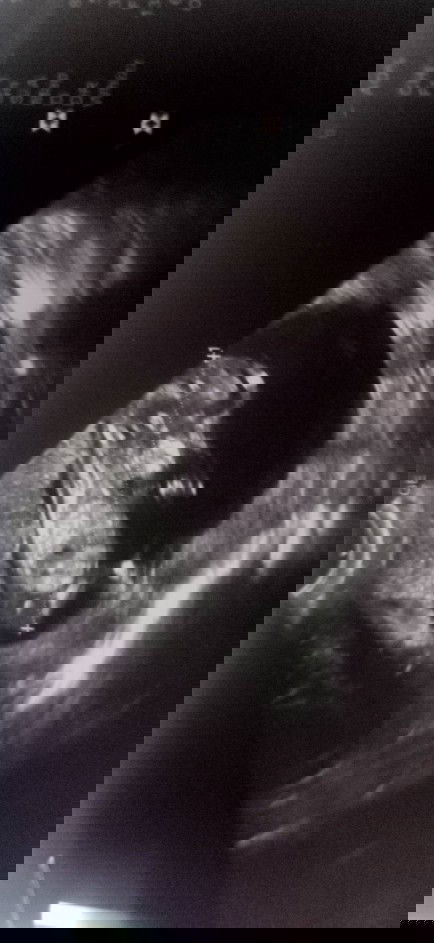 ชื่อเล่น