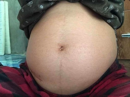 ทีมสิงหา 64 🎉