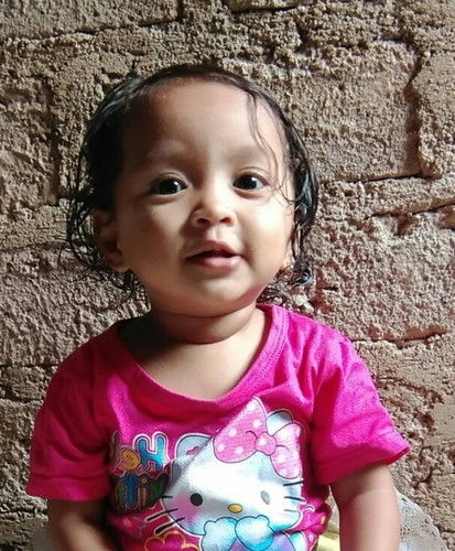 Anak sy sudah umur 1 Tahun 6 bulan belum bisa jalan