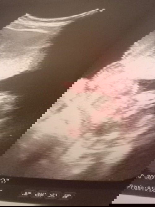 แบบนี้พอดูออกมั้ยคะว่าเพศอะไร