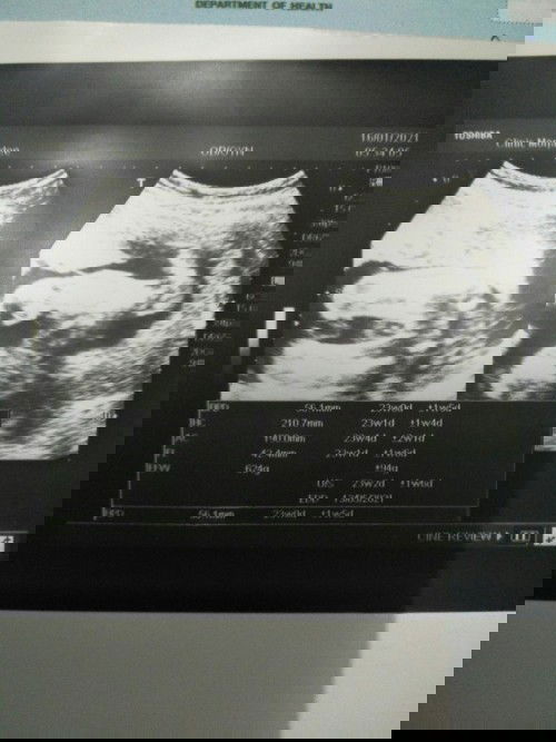 หมอบอกผู้หญิง