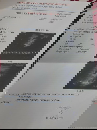 Mh bi lac noi mang trong co tu cung nhung dang mang thai cho mh hoi co anh huong gi ko a!