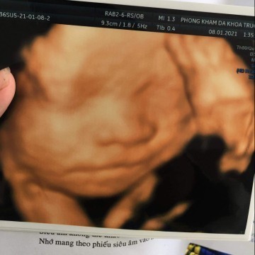 36w6d lên 10kg trâu vàng 3kg .
Nôn gặp con quá 😊