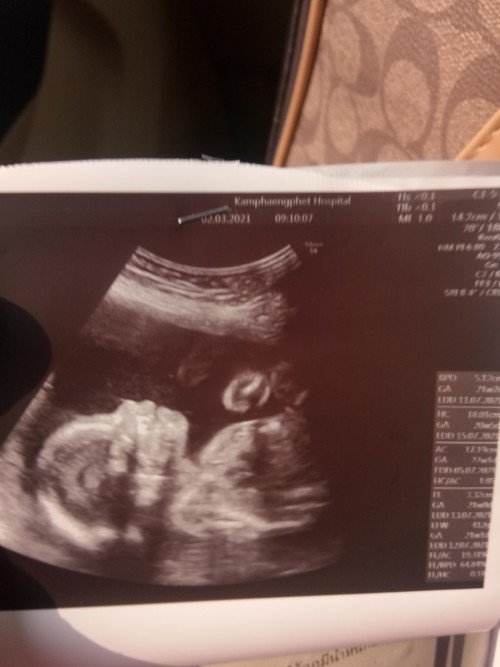 Post reply image