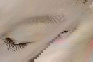 Foto dari google anak saya 4 th ngalamin kaya di foto, bagi sarannya yg udah pengalaman anaknya gini