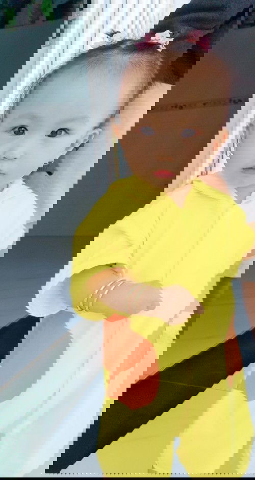 Bé bị đẹn trăng