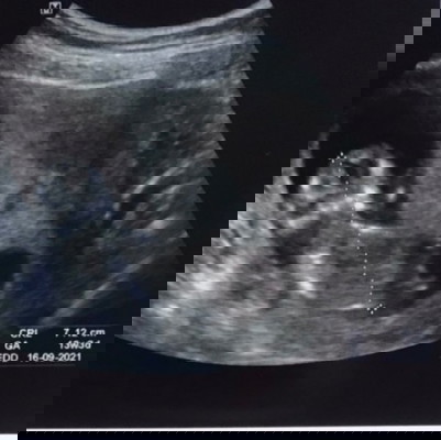 แม่ๆทีมกันยา น้องกี่ซม แล้วคะ 😊