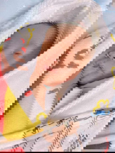 น้องตัวออกเหลืองและตาเหลืองค่ะ