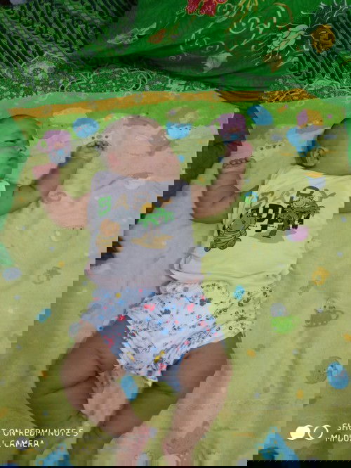 Lecet di lipatan kulit