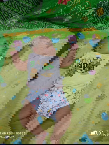 Lecet di lipatan kulit