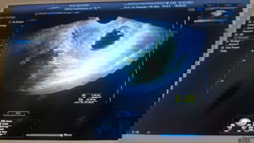 Usg berbeda dari hpht