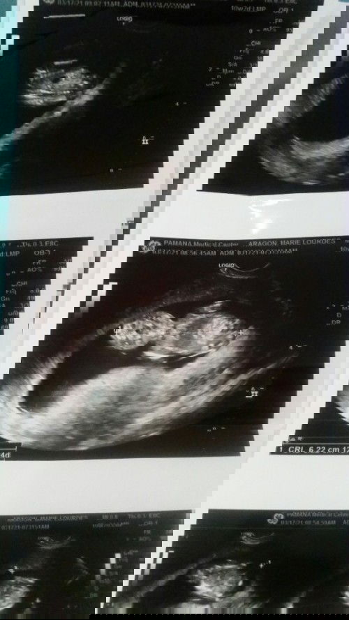 Concerned. Anyone had the same situation???