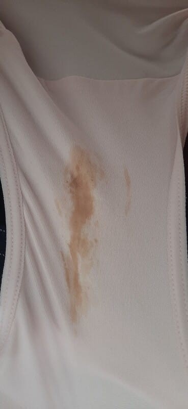 เลือดล้างหน้าเด็ก เป็นแบบไหน และมีอาการอะไรร่วมด้วยค่ะแม่ๆ