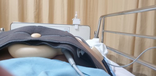 สภาวะคลอดก่อนกำหนด