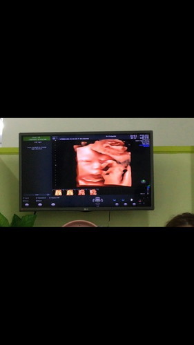 ฤกษ์ผ่าคลอดเมษายน2564