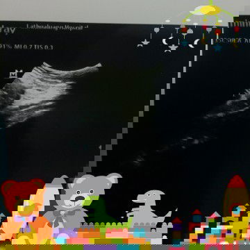 ท้องเเรกค้ะ