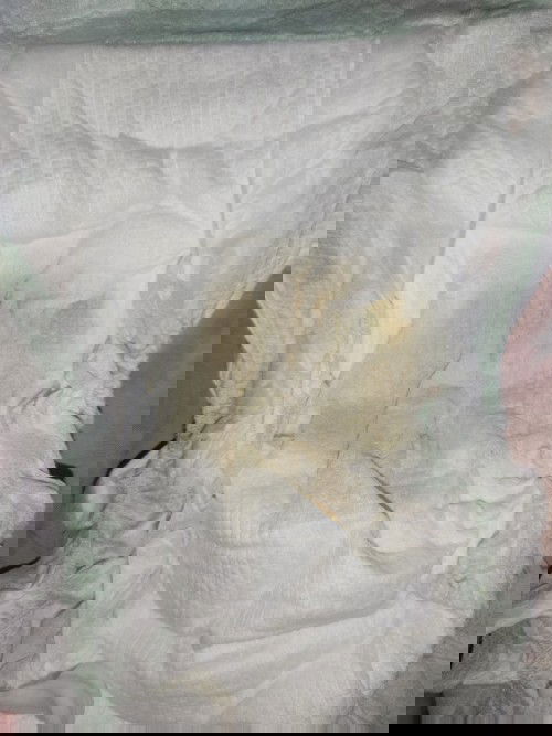 Mahinang umihi si baby🥺