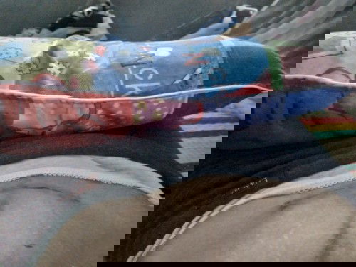 Em mới sinh mổ được 11 ngày có cách nào làm bung nhỏ lai bớt rạn không ạ