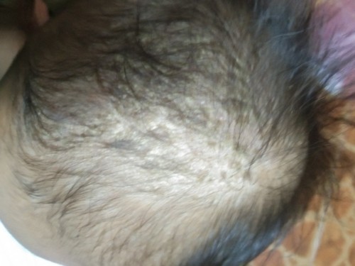 Cradle cap
Sana po mapansin ano po ang mabisang gamot sa cradle cap
Lumabas po nung 1 1/2 months