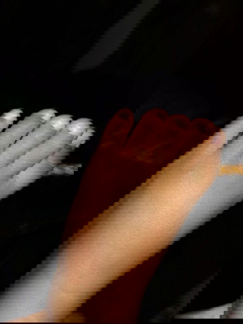 Ano po kayang gumagat dito.
At anu pong lunas nya